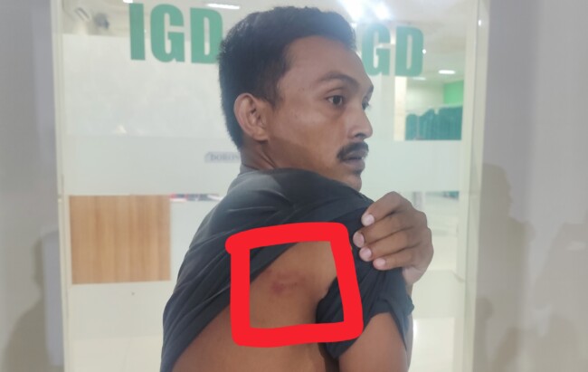 Breaking News: Oknum Polairud Polres Sikka Diduga Aniaya Dua Warga dengan Popor Senjata 2 IMG 20251130 223045