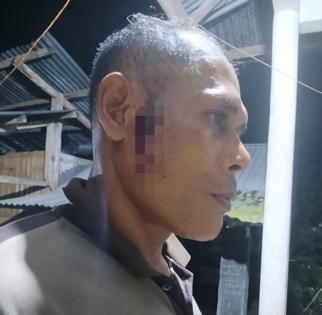 Aksi Brutal Kelompok Pemuda di Mauloo, Mobil Kopdit Pintu Air Dihadang dan Diserang, Sopir Luka-Luka 2 IMG 20260429 235506
